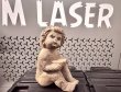 curatare laser